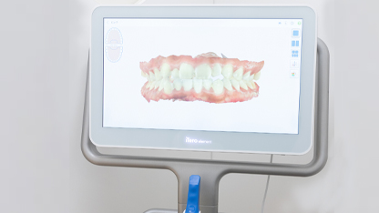 口腔内の状況を３D表示できるiTero